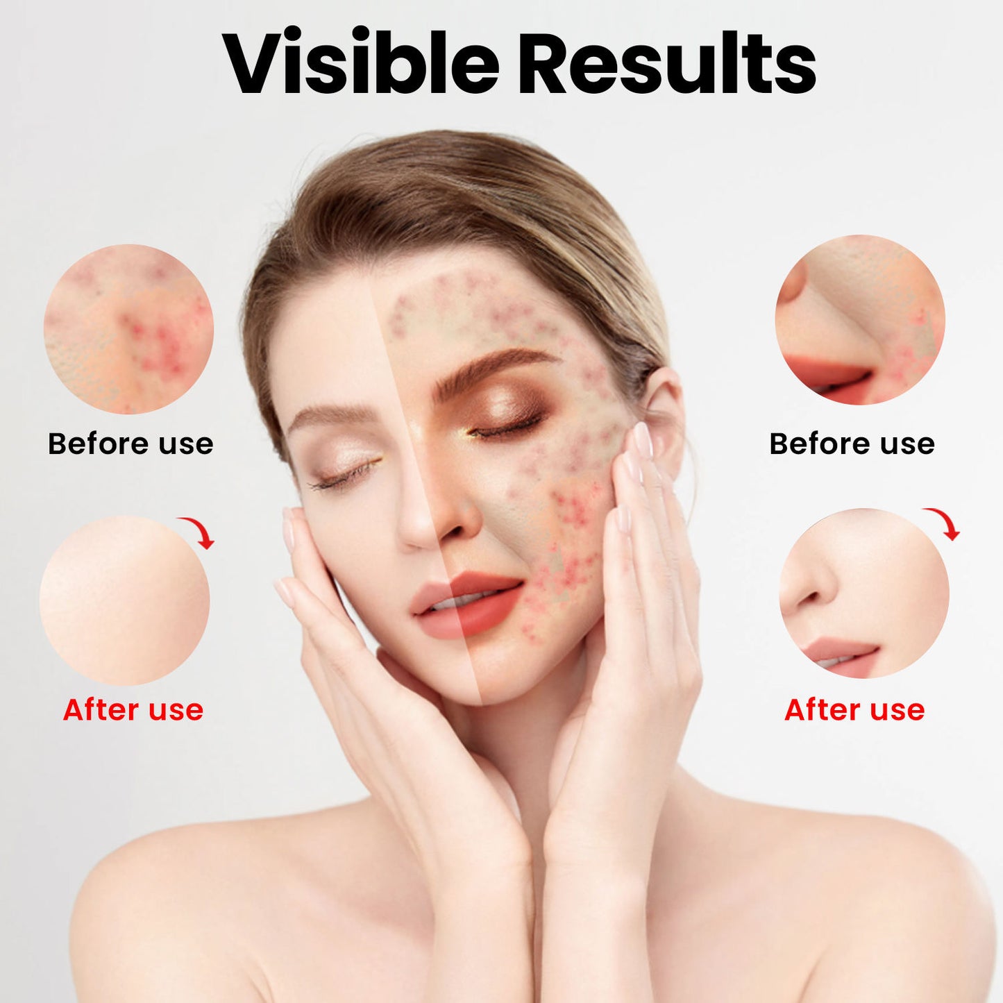 IDEATHERAPY 510K Professional Silicone Red Light Therapy Face Neck Mask Red Light Therapy Mask Led Facial Mask